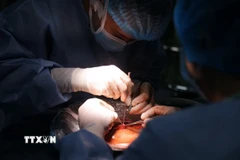 Một ca phẫu thuật ghép gan. (Ảnh: Minh Quyết/TTXVN)