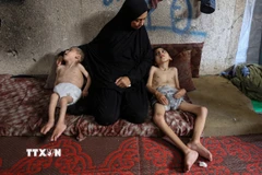 Trẻ em bị suy dinh dưỡng tại Dải Gaza. (Ảnh: THX/TTXVN)