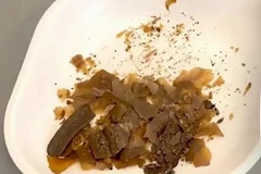 Các nhà nghiên cứu cho biết cặn bã được tìm thấy trong một chiếc bình cổ thời La Mã cung cấp bằng chứng hóa học đầu tiên về việc sử dụng phân làm thuốc. (Ảnh: Getty Images)