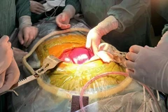Các bác sỹ thực hiện ca phẫu thuật. (Ảnh: Beicheng Sun)