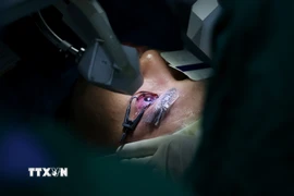 Phẫu thuật mắt bằng tia laser cho bệnh nhân. (Ảnh: Hồng Đạt/TTXVN)