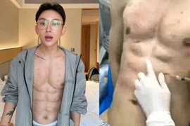 Cơ bụng nhân tạo của Andy Hao Tienan,. (Nguồn: odditycentral.com)