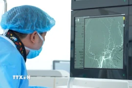 Bác sỹ Bệnh viện FV quan sát hình ảnh các mạch máu não quanh khối u trong quá trình làm tắc mạch. (Ảnh: TTXVN phát)