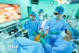 Các bác sỹ Bệnh viện Đại học Y dược Thành phố Hồ Chí Minh thực hiện phẫu thuật nội soi 3D thay van động mạch chủ kết hợp bắc cầu mạch vành. (Ảnh: TTXVN phát)
