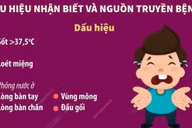 Bệnh tay chân miệng: Dấu hiệu nhận biết, nguồn truyền bệnh và cách phòng chống