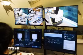 Phòng điều khiển hệ thống robot xạ phẫu CyberKnife S7. (Ảnh: TTXVN phát)