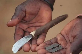 Phần tiểu phẫu trong nghi lễ trưởng thành dẫn đến cái chết của một số người tham gia mỗi năm. (Ảnh: Wvi).