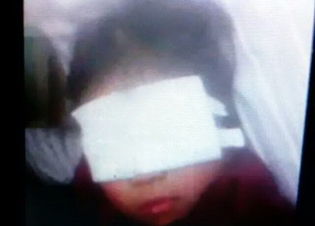 Người đàn ông xông vào lớp học, móc mắt bé gái 5 tuổi ảnh 1