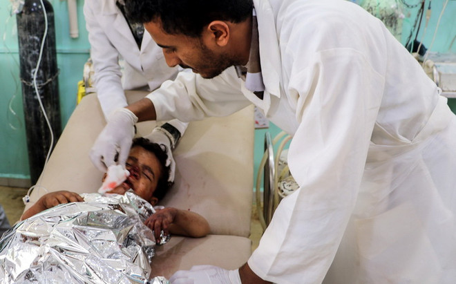 Liên quân Arab điều tra vụ tấn công xe buýt chở trẻ em ở Yemen ảnh 1