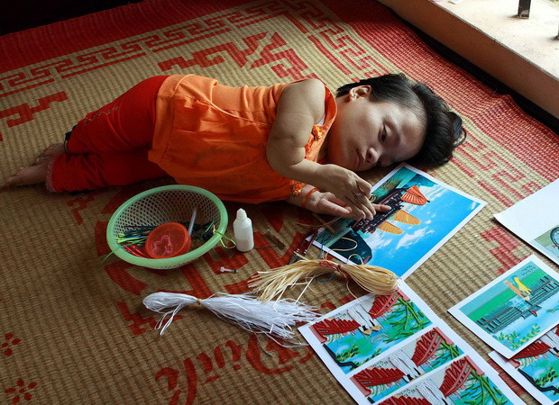 Cao Thị Út, ở xã Tân Thành, huyện Kim Sơn (Ninh Bình) bị di chứng chất độc da cam từ người cha. (Ảnh: Nguyễn Thủy/TTXVN) Đấu tranh cho nạn nhân da cam Việt Nam: Chờ thời cơ thuận lợi ảnh 1