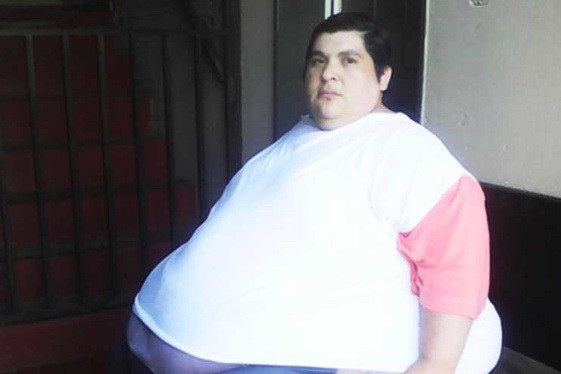 Một phụ nữ nặng 360kg muốn thu nhỏ dạ dày để có thể giảm cân ảnh 1