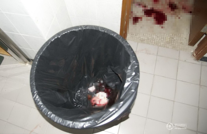 Bàng hoàng em bé bị vứt ngay vào thùng rác khi vừa chào đời ảnh 1