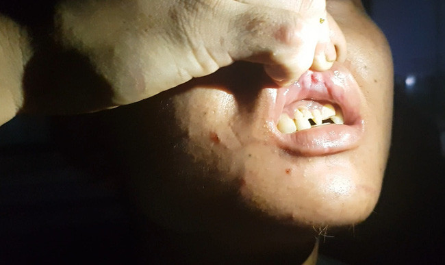 Tạm giữ khẩn cấp đối tượng bạo hành người làm thuê tại Bắc Ninh ảnh 1