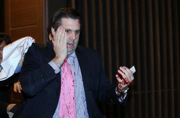 Chân dung đối tượng dùng dao tấn công Đại sứ Mỹ tại Hàn Quốc ảnh 1