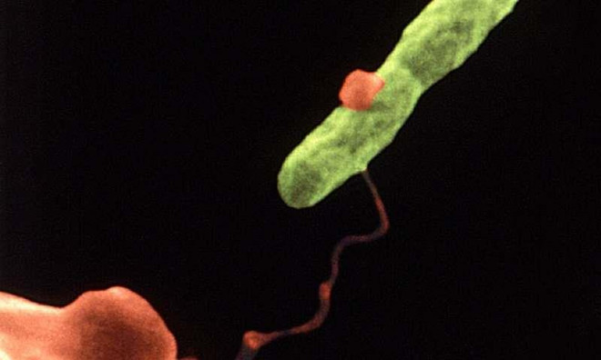 [Video] Phương pháp mới phát hiện vi khuẩn trong vài phút ảnh 1