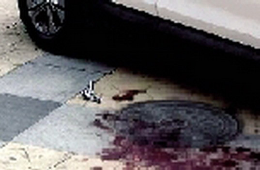 Mẹ mải xem điện thoại, cậu bé 2 tuổi bị bánh xe nghiền qua ảnh 1