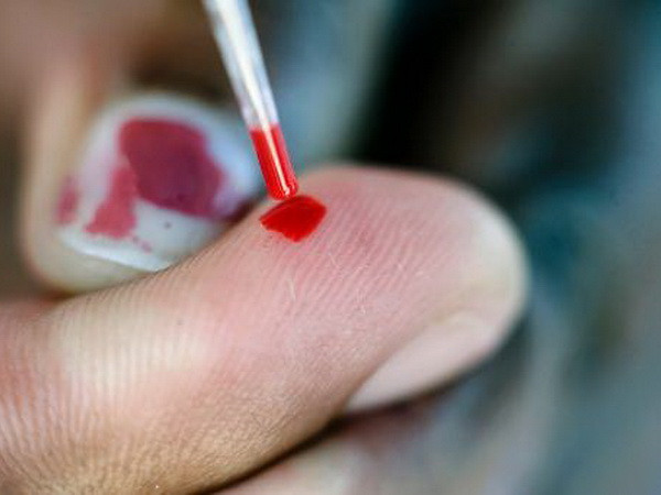 Nguy cơ lây nhiễm HIV từ “cha nuôi” tại Nam Phi ảnh 1