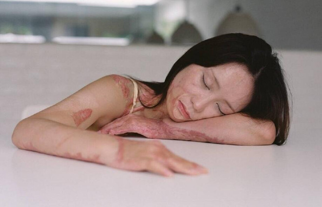 Bộ ảnh của cô gái bị bạn học tẩm xăng đốt gây sốt ở Trung Quốc ảnh 3