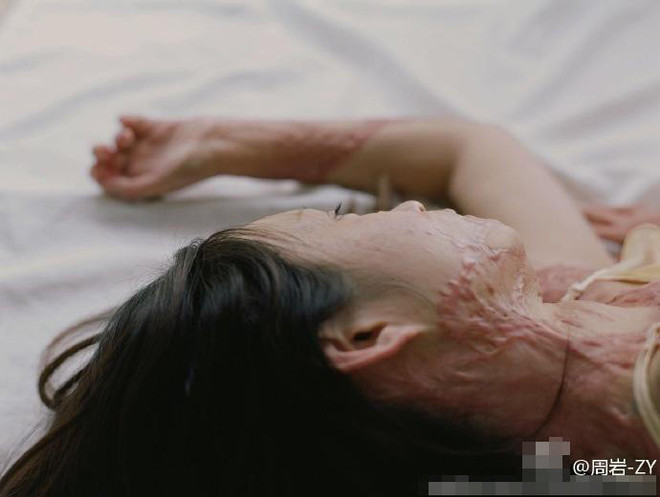 Bộ ảnh của cô gái bị bạn học tẩm xăng đốt gây sốt ở Trung Quốc ảnh 8