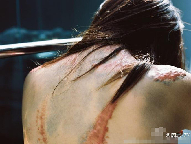 Bộ ảnh của cô gái bị bạn học tẩm xăng đốt gây sốt ở Trung Quốc ảnh 7