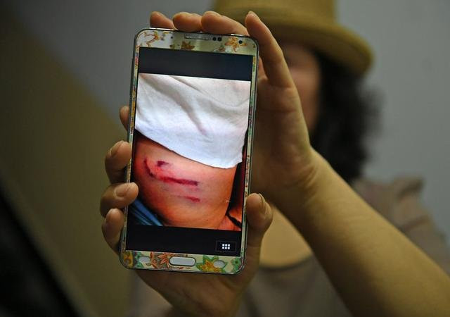 Hơn 100 em học sinh bị thầy giáo dùng gậy thép đánh đập ảnh 2