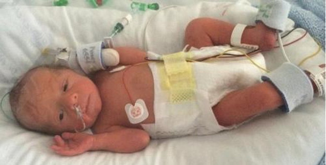 Không thấy em bé sau khi bác sỹ phẫu thuật sinh mổ cho người mẹ ảnh 1