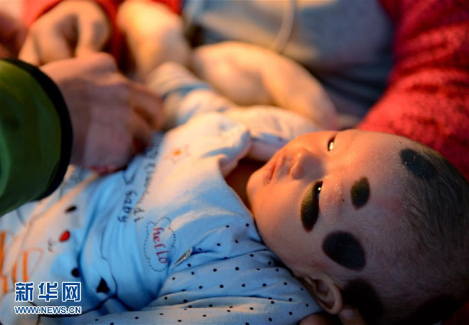Cảm thương em bé 2 tháng tuổi sống với làn da "quái vật" ảnh 3