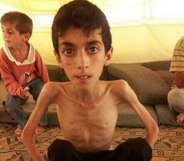 Ám ảnh mùi xác chết phảng phất tại thị trấn nhỏ ở Syria ảnh 1