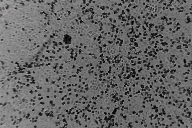 Các nhà khoa học Thụy Sỹ phát hiện sức mạnh chống virus của đường ảnh 1