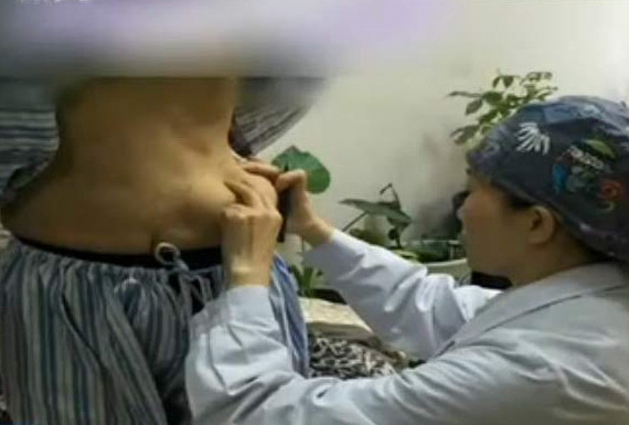 (Nguồn: 163) Miếng keo độn ngực trôi tuột xuống bụng sau vài năm phẫu thuật ảnh 1