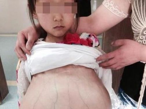 Xác nhận thông tin về bé gái đi khám thai tại Trung Quốc ảnh 1