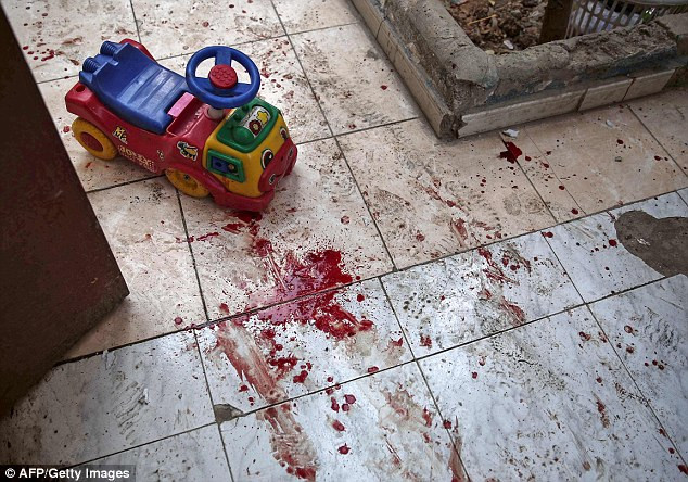 Xót xa các em bé Syria bị thương khi trường mầm non bị đánh bom ảnh 2