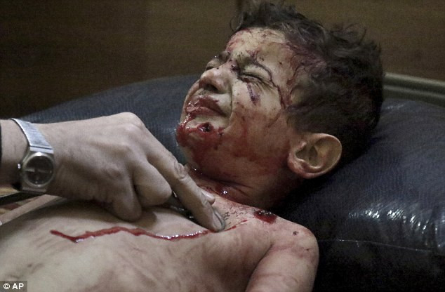 Xót xa các em bé Syria bị thương khi trường mầm non bị đánh bom ảnh 1