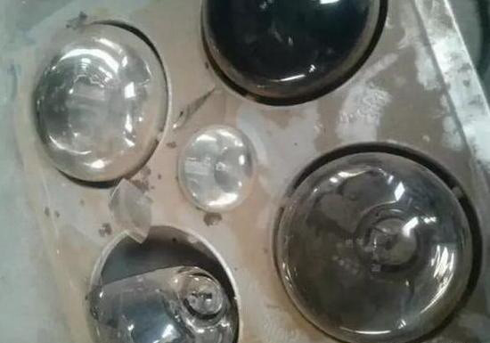 Bị bỏng toàn thân khi đang tắm vì đèn sưởi bất ngờ phát nổ ảnh 1