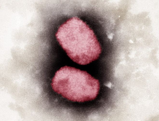 Nhiều nước châu Âu ghi nhận các ca mắc bệnh đậu mùa khỉ ảnh 1