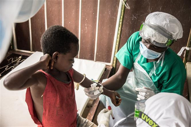 Giới chuyên gia y tế thế giới trấn an về bệnh đậu mùa khỉ ảnh 1