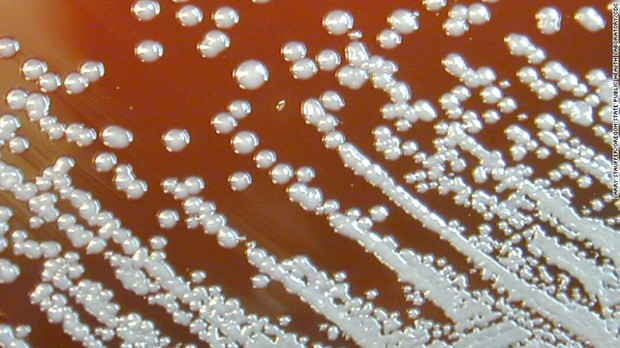 Thanh Hóa ra văn bản khẩn tăng cường phòng, chống bệnh Whitmore ảnh 1