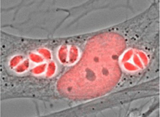 Mexico báo động trẻ sơ sinh nhiễm ký sinh trùng gây não úng thủy ảnh 1