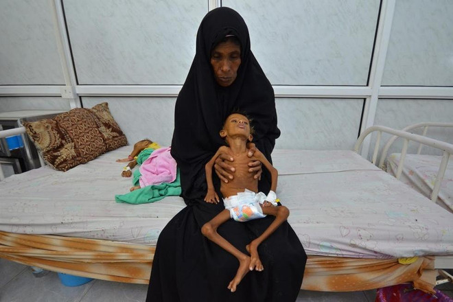 Bạn sẽ rớt nước mắt khi xem những hình ảnh này về Yemen ảnh 4