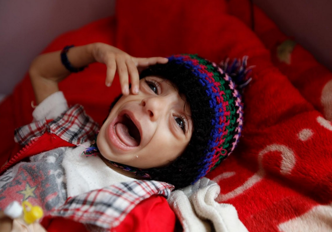 Bạn sẽ rớt nước mắt khi xem những hình ảnh này về Yemen ảnh 2