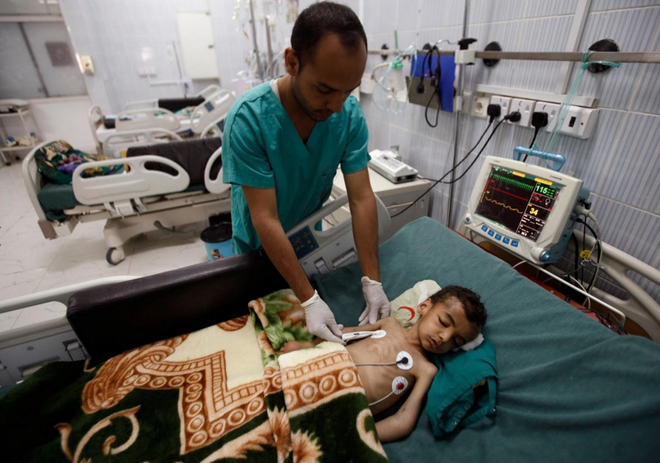 Bạn sẽ rớt nước mắt khi xem những hình ảnh này về Yemen ảnh 5