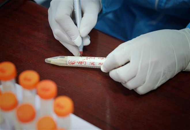 Ngày 30/10, ghi nhận 5.227 ca mắc mới COVID-19 và 64 ca tử vong ảnh 1