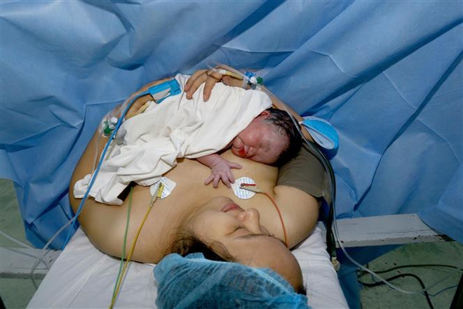 Hỗ trợ từ xa, sản phụ mắc chứng tăng đông máu 'vượt cạn' thành công ảnh 2