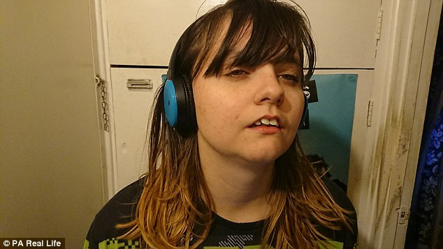 Cô gái mắc chứng bệnh lạ cần ngủ đến 21 tiếng một ngày ảnh 1