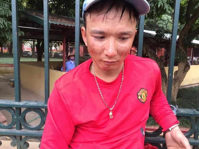 Không đội mũ bảo hiểm, tên cướp bị 141 lật tẩy hành vi cướp giật ảnh 1