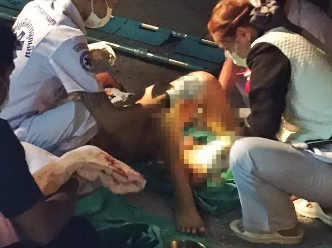 Không kịp đến bệnh viện, người chồng đỡ đẻ cho vợ ngay trên đường ảnh 2