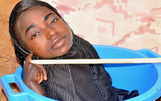 Cô gái đi lại bằng chậu nhựa gây xôn xao dư luận ở Nigeria ảnh 1