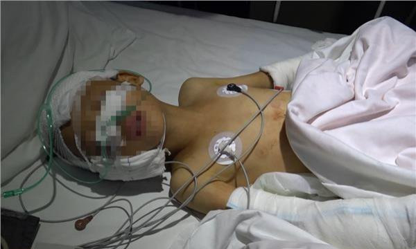 Mẹ kế chém con chồng hơn 20 nhát dao trong đêm Trung Thu ảnh 1