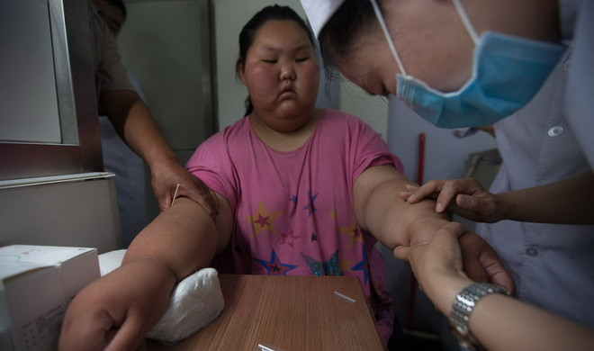 Cuộc sống vô cùng đáng thương của một cô bé mắc chứng béo phì ảnh 10