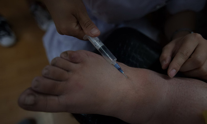 Cuộc sống vô cùng đáng thương của một cô bé mắc chứng béo phì ảnh 13